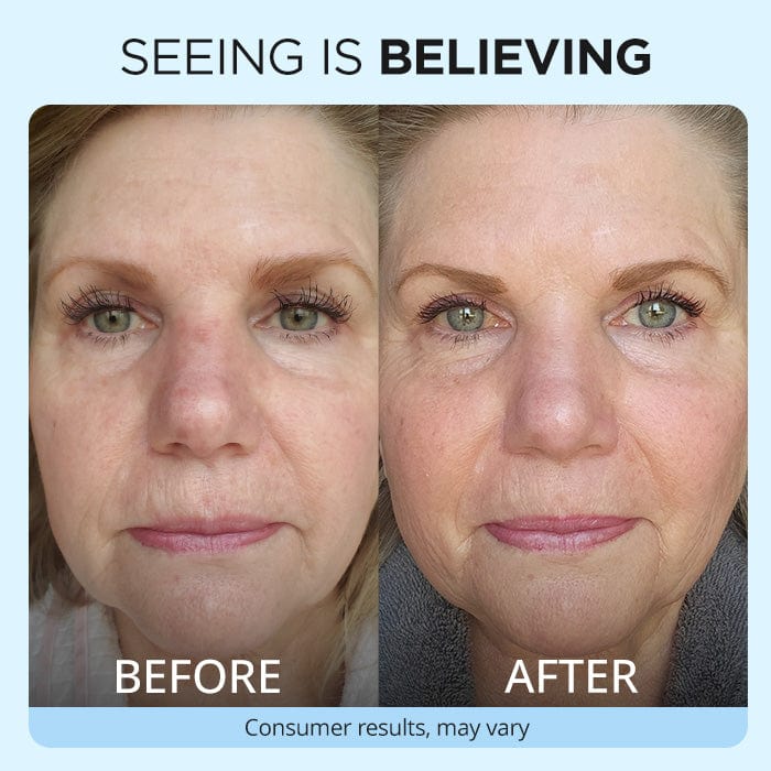 Anti Wrinkle Moisturizer