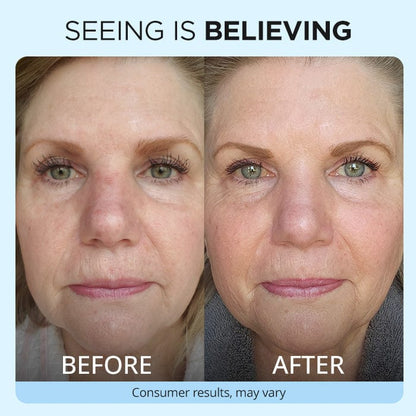 Anti Wrinkle Moisturizer
